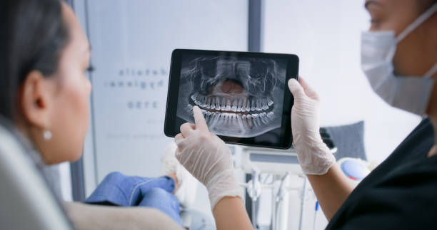 Licensed Tooth Extraction service in London, OH - Smile Center Dentistry